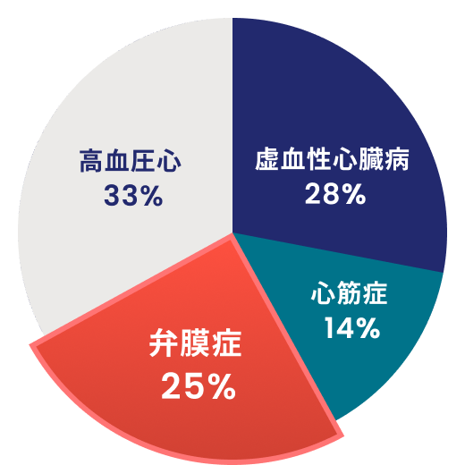 日本における心不全の原因疾患の内訳を示した円グラフ 虚血性心臓病が28%、心筋症が14%、弁膜症が25%、高血圧心が33%