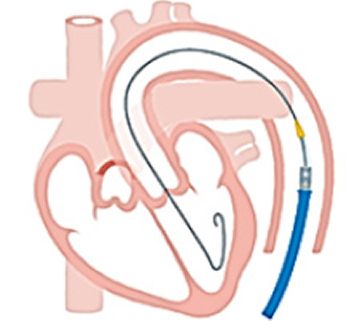 治療の流れ 画像1