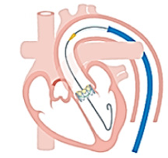 治療の流れ 画像3