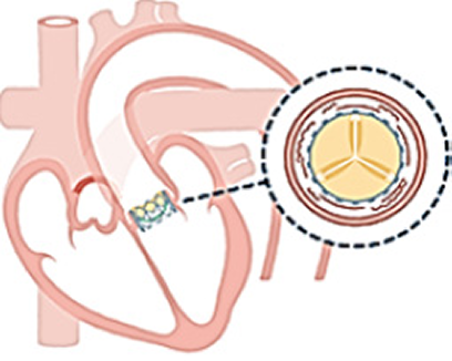 治療の流れ 画像4