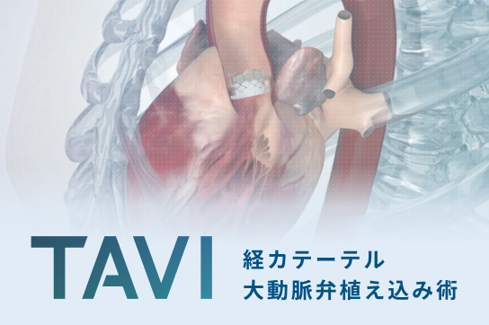 開胸せず治療できる、 従来の手術より身体に負担が少ない患者さんにやさしい低侵襲治療です。